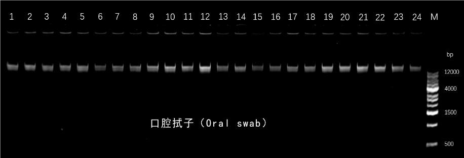 磁珠法口腔拭子基因组提取试剂盒